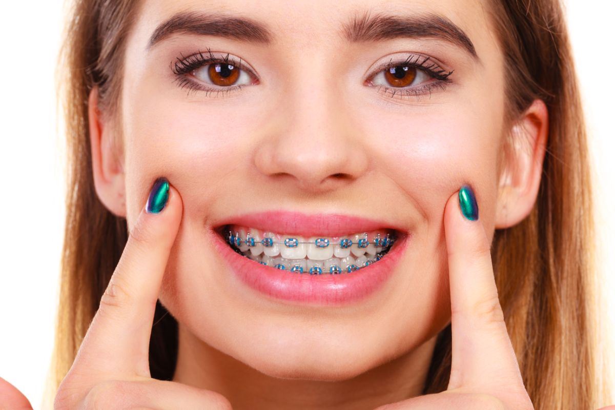 braces at white house orthodontics