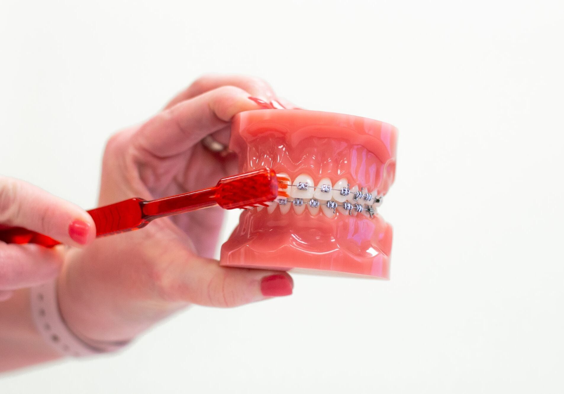 Orthodontic Care Guide – Braces in Portland TN & White House TN Orthodontic care and braces maintenance tips from Wiesemann Orthodontics serving Portland TN and White House TN